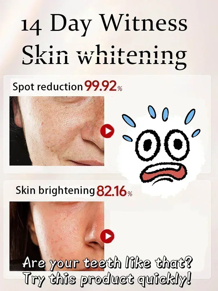 Remove Dark Spots Whitening Freckle Cream