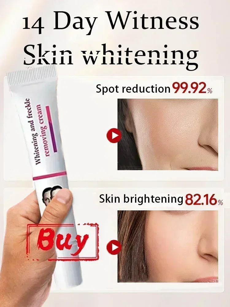 Remove Dark Spots Whitening Freckle Cream