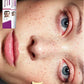 Remove Dark Spots Whitening Freckle Cream